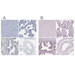 Anti-SLC45A3 antibody produced in rabbit Prestige Antibodies&#174; Powered by Atlas Antibodies, affinity isolated antibody, buffered aqueous glycerol solution