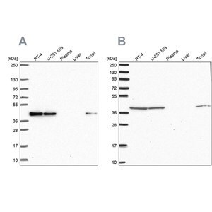Anti-IDH3B antibody produced in rabbit Prestige Antibodies&#174; Powered by Atlas Antibodies, affinity isolated antibody