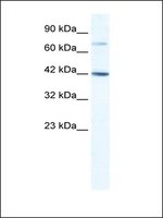 Anti-GLI4 antibody produced in rabbit IgG fraction of antiserum