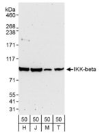 Rabbit anti-IKK-beta Antibody, Affinity Purified Powered by Bethyl Laboratories, Inc.
