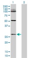 Anti-C11orf17 antibody produced in rabbit purified immunoglobulin, buffered aqueous solution