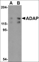 Anti-ADAP (ab1) antibody produced in rabbit affinity isolated antibody, buffered aqueous solution