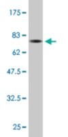Monoclonal Anti-SQSTM1 antibody produced in mouse clone 1C9, purified immunoglobulin, buffered aqueous solution