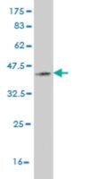 Monoclonal Anti-PRKG1 antibody produced in mouse clone 5E5, purified immunoglobulin, buffered aqueous solution