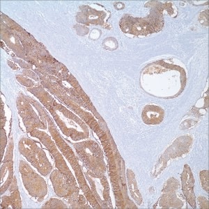 Ep-CAM/Epithelial Specific Antigen (MOC-31) Mouse Monoclonal Antibody