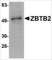 Anti-ZBTB2 antibody produced in rabbit affinity isolated antibody, buffered aqueous solution