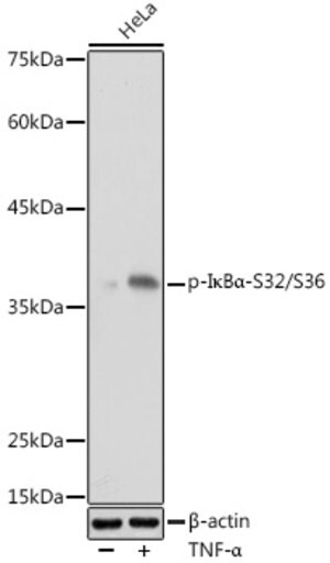Anti-Phospho-I&#954;B&#945;-S32/S36 antibody produced in rabbit