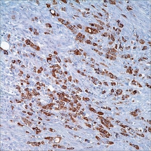 Mammaglobin Cocktail (304-1A5 &amp; 31A5) Mouse/Rabbit Monoclonal Antibodies