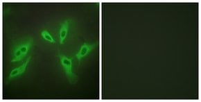 Anti-TUSC3 antibody produced in rabbit affinity isolated antibody
