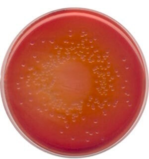 含结晶紫、氯化钠和 0.15% 胆盐的麦康凯琼脂 NutriSelect&#174; Plus, suitable for microbiology