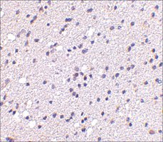 Anti-CAPS2 antibody produced in rabbit affinity isolated antibody, buffered aqueous solution