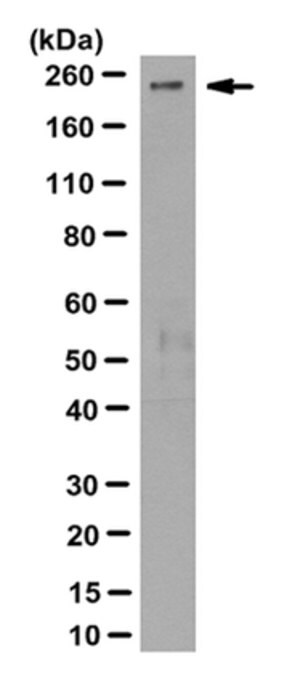 Anti-PIKFYVE Antibody, clone R159.4.3C9 clone R159.4.3C9, from mouse