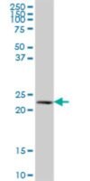 Anti-NAT9 antibody produced in mouse IgG fraction of antiserum, buffered aqueous solution