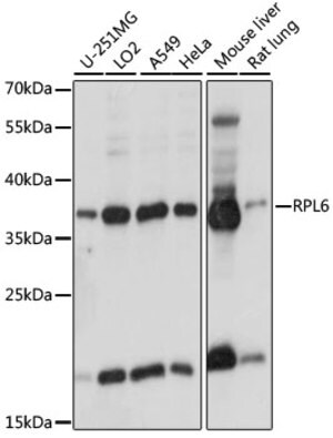 Anti-RPL6 antibody produced in rabbit