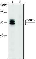 Anti-SARS2 (336-350) antibody produced in rabbit IgG fraction of antiserum