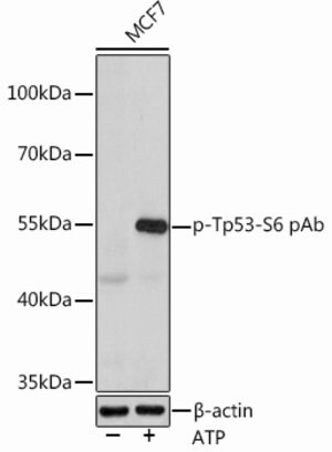 Anti-Phospho-Tp53-S6 antibody produced in rabbit