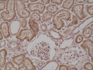 Anti-BRAFantibody, Rabbit Monoclonal recombinant, expressed in HEK 293 cells, clone RM308, purified immunoglobulin