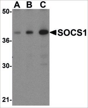 Anti-SOCS1 (ab1) antibody produced in rabbit affinity isolated antibody, buffered aqueous solution