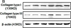 单克隆抗-胶原蛋白，I型 小鼠抗 clone COL-1, ascites fluid