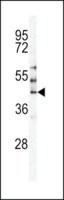 ANTI-MST3(C-TERMINAL) antibody produced in rabbit IgG fraction of antiserum, buffered aqueous solution