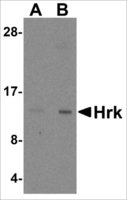 Anti-HRK antibody produced in rabbit affinity isolated antibody, buffered aqueous solution