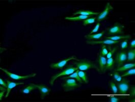 Anti-TNK2 antibody produced in rabbit purified immunoglobulin, buffered aqueous solution