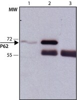 Anti-p62/SQSTM1 antibody produced in rabbit ~1&#160;mg/mL, affinity isolated antibody, buffered aqueous solution