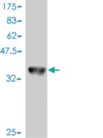 Monoclonal Anti-MAP2K1 antibody produced in mouse clone 1B5, purified immunoglobulin, buffered aqueous solution