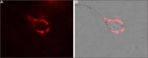 Anti-Calcium Channel (&#945;2/&#948;-1 Subunit) antibody produced in rabbit affinity isolated antibody, lyophilized powder