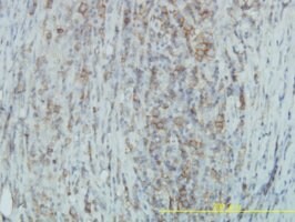 Monoclonal Anti-TYK2 antibody produced in mouse clone 6H1, purified immunoglobulin, buffered aqueous solution