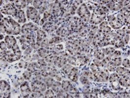 Monoclonal Anti-LIMD1 antibody produced in mouse clone 2G5, purified immunoglobulin, buffered aqueous solution