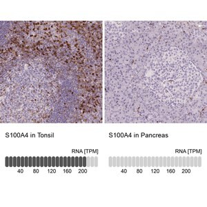 Monoclonal Anti-S100A4 antibody produced in mouse Prestige Antibodies&#174; Powered by Atlas Antibodies, clone CL0240, purified immunoglobulin, buffered aqueous glycerol solution
