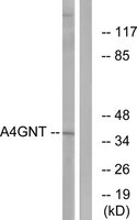 Anti-A4GNT antibody produced in rabbit affinity isolated antibody