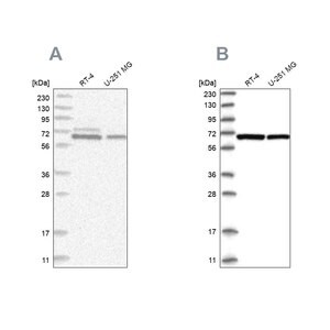 Anti-PGM3 antibody produced in rabbit Prestige Antibodies&#174; Powered by Atlas Antibodies, affinity isolated antibody, buffered aqueous glycerol solution, ab2