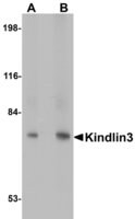 Anti-KINDLIN3 antibody produced in rabbit affinity isolated antibody, buffered aqueous solution