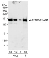 Rabbit anti-ATAD5/FRAG1 Antibody, Affinity Purified