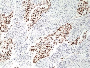 Anti-p53 Rabbit Monoclonal Antibody clone RM387, affinity purified immunoglobulin