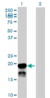 Anti-BRSK2 antibody produced in mouse purified immunoglobulin, buffered aqueous solution