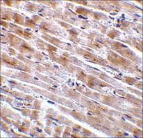 Anti-CTRP3 antibody produced in rabbit affinity isolated antibody, buffered aqueous solution