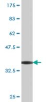 Monoclonal Anti-TNKS antibody produced in mouse clone 1A3, purified immunoglobulin, buffered aqueous solution
