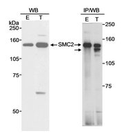 Rabbit anti-SMC2 Antibody, Affinity Purified Powered by Bethyl Laboratories, Inc.