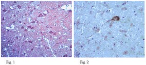 Anti-Neurexin3 Antibody from rabbit, purified by affinity chromatography