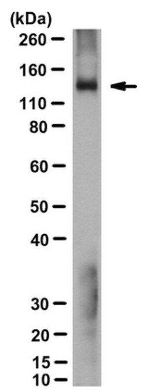 抗-腺苷酸环化酶5抗体，克隆19D5.C1 clone 19D5.C1, from mouse