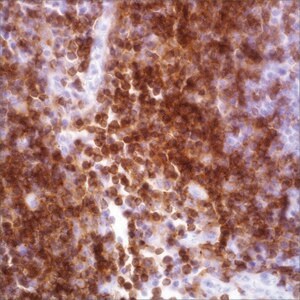 CD4 (EP204) Rabbit Monoclonal Primary Antibody