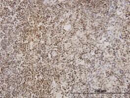 Monoclonal Anti-TNKS antibody produced in mouse clone 1A2, purified immunoglobulin, buffered aqueous solution