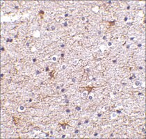 Anti-TMP21 (ab1) antibody produced in rabbit affinity isolated antibody, buffered aqueous solution