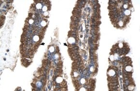 Anti-PGRMC1 antibody produced in rabbit affinity isolated antibody