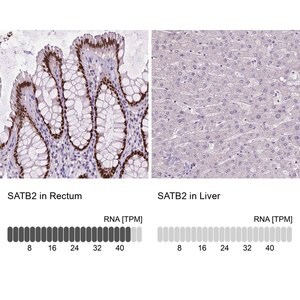 Monoclonal Anti-SATB2 antibody produced in mouse Prestige Antibodies&#174; Powered by Atlas Antibodies, clone CL0319, purified immunoglobulin, buffered aqueous glycerol solution