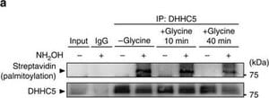 Anti-ZDHHC5 antibody produced in rabbit Prestige Antibodies&#174; Powered by Atlas Antibodies, affinity isolated antibody, buffered aqueous glycerol solution