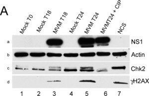 Anti-Chk2 Antibody, clone 7 clone 7, Upstate&#174;, from mouse